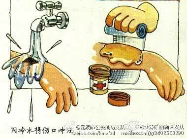 小儿烫伤急救法 烫伤急救法及康复保护