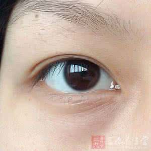 黑眼圈怎么去除 黑眼圈 黑眼圈怎么去除