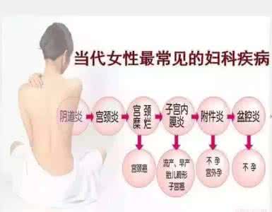 霉菌性阴道炎怎么治疗 霉菌性阴道炎的家庭护理