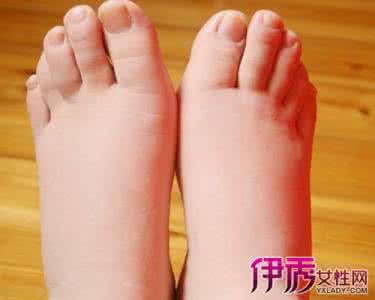 孕晚期脚肿怎么缓解 孕晚期脚肿怎么缓解 孕晚期吃什么能缓解脚肿