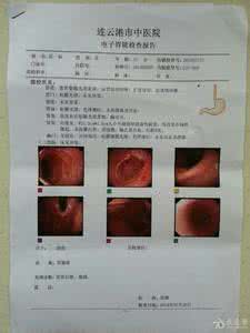 胃癌术后化疗方案 胃癌术后化疗方案 胃癌术后化疗