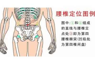 腰间盘突出治疗偏方 治疗腰间盘突出偏方 腰间盘突出如何饮食