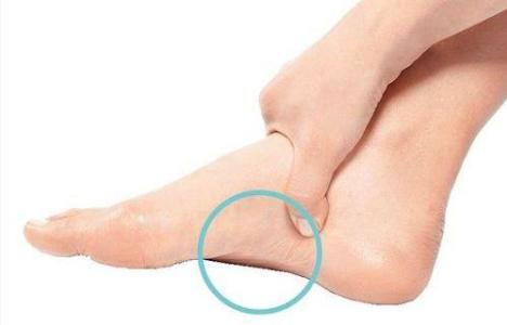 孩子扁平足怎么办 预防扁平足 如何预防孩子得上扁平足