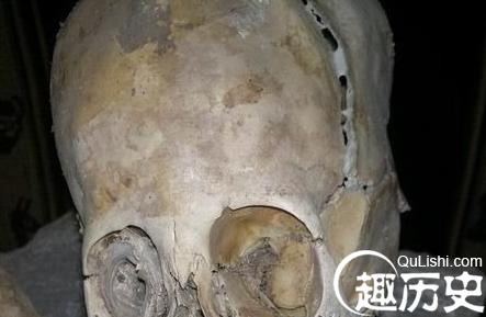 秘鲁外星人 秘鲁惊现巨大的外星人婴儿头骨