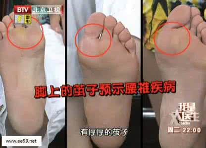 我是大医生2015年5月14日视频,周福德,被忽视的伤肾陷阱