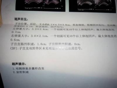 子宫积液是什么 子宫积液是什么 子宫积液的病因是什么