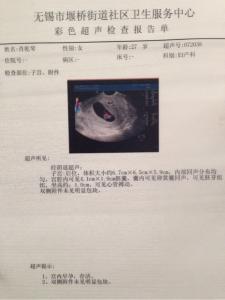 中晚孕普通彩超检查 孕妈普通B超与彩超如何选择