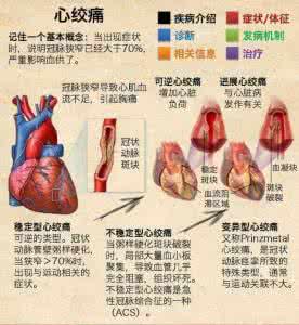 心绞痛图片 【读图】一图读懂 心绞痛