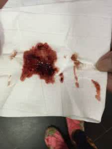 两个月没来月经怎么办 月经来了两个月怎么办