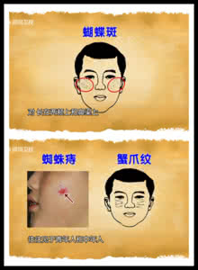 天天养生王鸿谟 从面部看肝脏《天天养生》王鸿谟