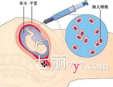 血性羊水 如何预防血性羊水