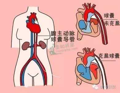 头胎剖腹产二胎顺产 头胎剖腹产二胎能顺产 头胎剖腹产，隔多久生第二个孩子比较好？