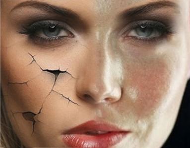 如何改变皮肤粗糙 脸上皮肤粗糙怎么办 冬季吃这些改变皮肤粗糙 让皮肤更加水嫩