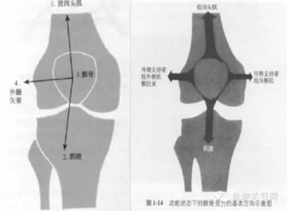 髌股关节综合征 膝盖说不出哪痛，可能是髌股关节综合征