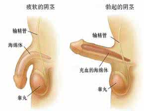 勃起功能障碍的原因 勃起功能障碍的原因有哪些