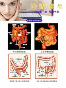 人体的宿便能有多少斤 人体内有10斤宿便