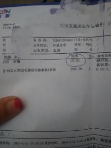怀孕多久检查孕酮 检查孕酮能知道怀孕吗?