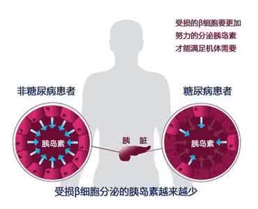 西格列汀 沙格列汀治疗2型糖尿病疗效确切且可改善胰岛β细胞功能