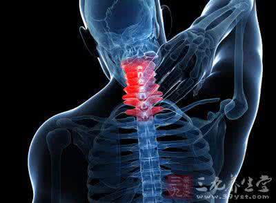 脖子疼是颈椎病吗 颈椎病怎么治疗 3种方法让你的脖子解放