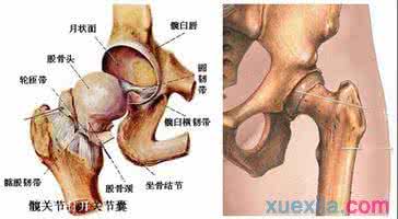 股骨头坏死的治疗方法 股骨头坏死的治疗方法 股骨头坏死如何治 这方法可以治疗