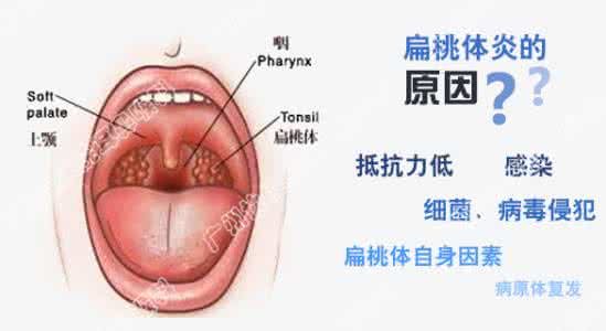 小孩急性扁桃体炎 三岁小孩急性扁桃体炎怎么办