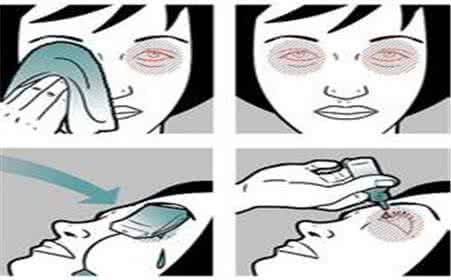 红眼病发病季节 红眼病的症状 红眼病流行快发病急