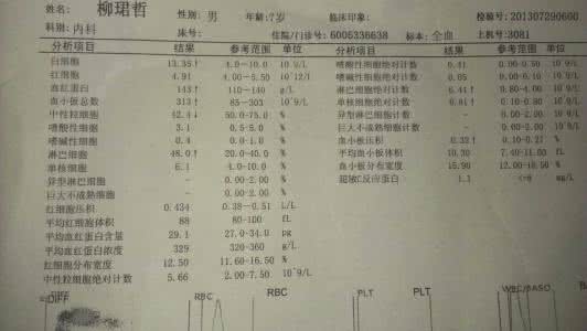 川崎病症状如何治疗 什么是川崎病 川崎病的症状与治疗