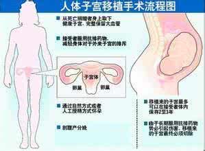 先天性子宫发育异常 先天性子宫发育异常 子宫发育异常的危害
