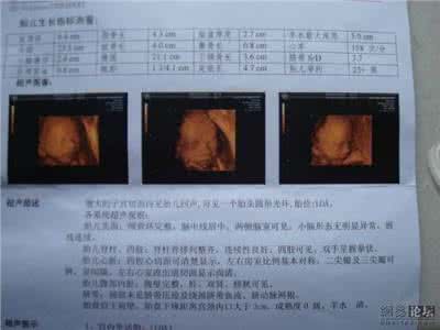 做三维彩超最佳时间 三维彩超检查的四个阶段