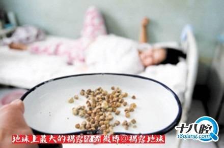 不吃早餐会得胆结石 不吃早餐为什么会引发胆结石