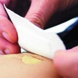 奇效的敷脐疗法 奇效的敷脐疗法 什么时候可以使用贴敷脐疗法