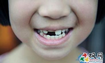 做梦梦到牙齿掉了一颗 做梦梦见牙掉了 梦见牙齿掉了一颗