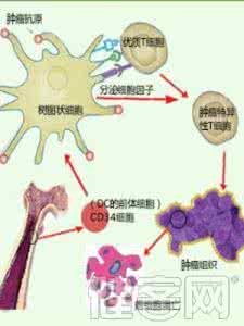 肿瘤细胞免疫疗法 抗肿瘤战役利剑出鞘 生物细胞免疫疗法