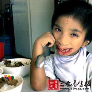 大头娃娃事件 医学家鉴别出“大头娃娃”致病基因