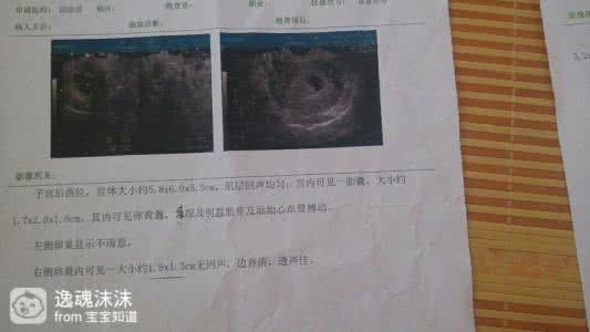 阴超几周可见胎心胎芽 检查胎心胎芽要阴超吗?
