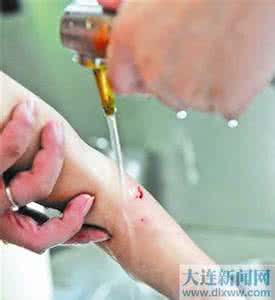 盐水清洗伤口疼吗 盐水清洗伤口疼吗 伤口可以用盐水洗疼吗?