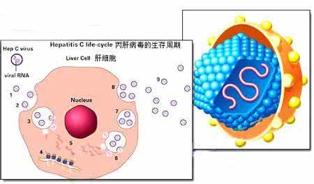 丙型肝炎病毒 丙型肝炎病毒严重吗？