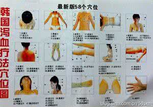 腰间盘突出治疗 转载 （一）泻血治疗腰间盘突出
