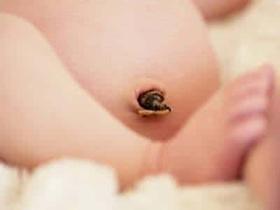 宝宝脐带多久才脱落 如何守护宝宝脐带健康