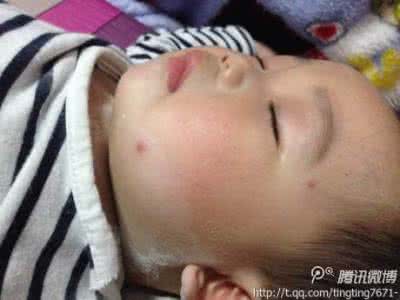 什么人容易被蚊子咬 花脚蚊 什么人容易被蚊子咬