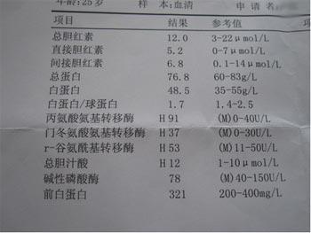 肝功能下降的表现 肝功能异常的表现有哪些
