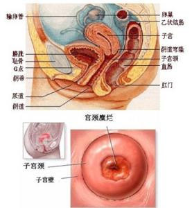 宫颈糜烂会自愈吗 宫颈糜烂影响生育吗