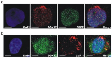 急性前列腺炎主要原因 Nature Genetics研究揭示基因炎性疾病主要原因