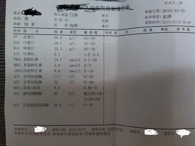 检查肝功能要多少钱 肝功能检查
