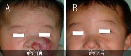 烤烟型和混合型的区别 混合型与烤烟型谁更好 红酒梨汤混合更好哦！喝红酒有什么好处？