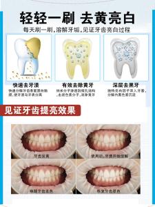 快速去除牙结石 快速去除牙结石 如何快速去除牙黄呢？