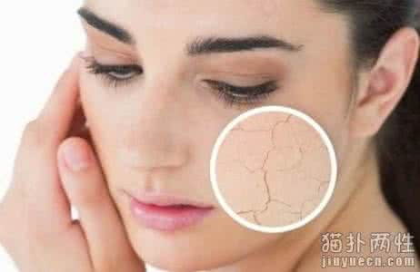 皮肤干燥吃什么水果好 皮肤干燥吃什么水果？怎样预防皮肤干燥？
