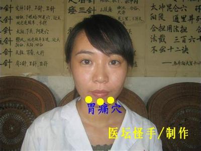 王文远平衡针灸 王文远平衡针炙的38个穴位图(新创穴位特有