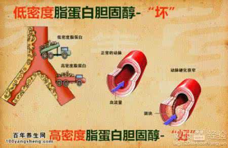 低密度脂蛋白胆固醇 治疗低密度胆固醇高 低密度脂蛋白胆固醇偏高的原因