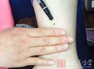 黄体萎缩不全 黄体萎缩不全怎么调理 额头上肌肉萎缩的自我调理